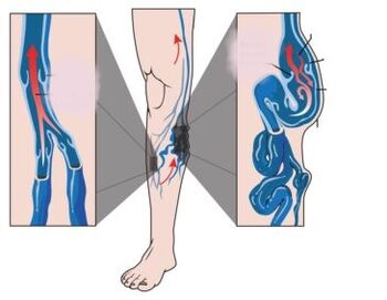 Príčiny, symptómy